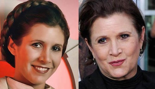 Carrie-Fisher-Plastic-Surgery-Before-After.jpg