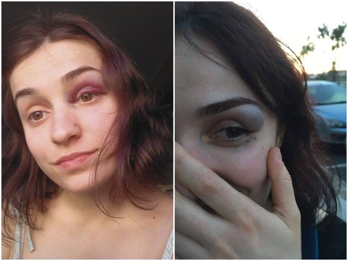 Ataque homofóbico em Lx.jpg