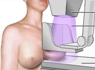 mamografia2_1042.jpg