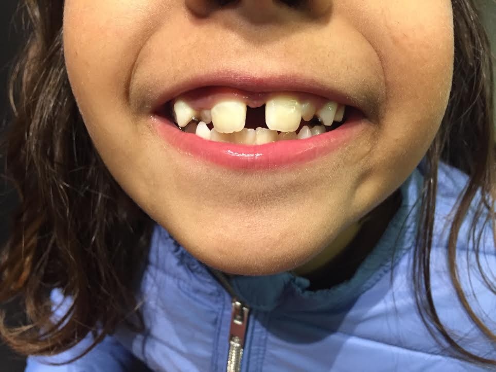 mada dentes 2:2.jpg