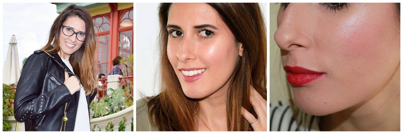 Antes_depois_Before_after_sorriso gengival_botox_ Antes_depois_Before_after_sorriso gengival_botox_