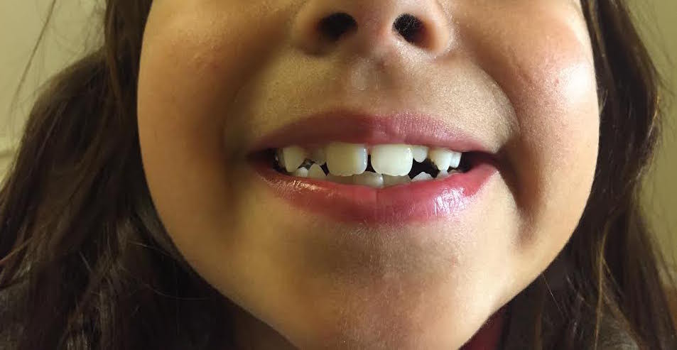 mada dentes 1:1.jpg