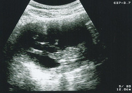 2013-04-12_ecografia 14 semanas.jpg